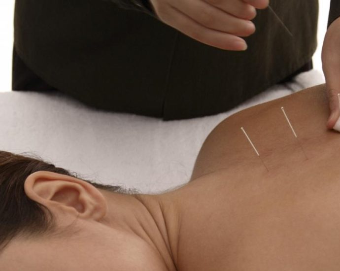 Acupuncture A Traditional Chinese Medicine Approach to Health