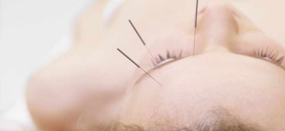 Finding Relief from Hayfever with Acupuncture
